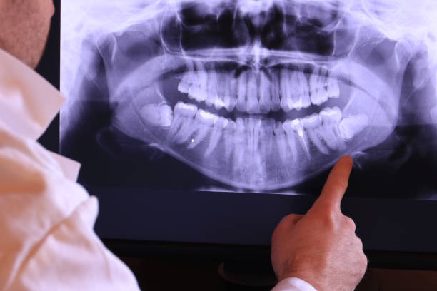Best Emergency Treatment for Jaw Pain or Injury in Totowa, NJ