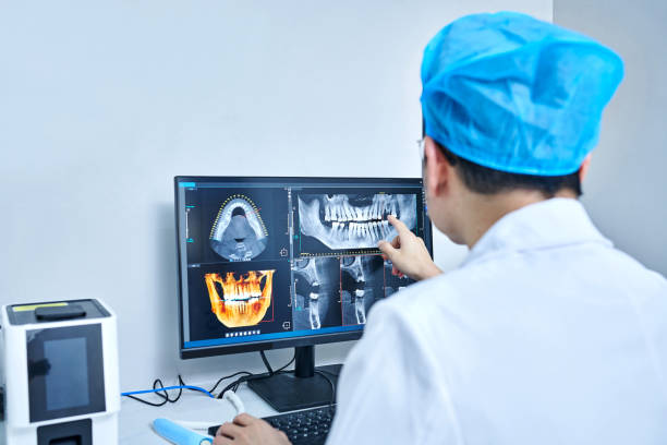 Best Knocked-Out Tooth (Avulsed Tooth) Treatment in Totowa, NJ